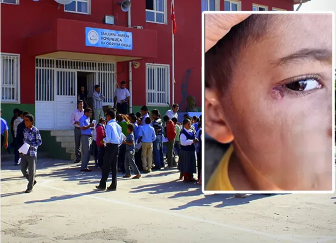 Harran ilçesindeki bir okulda hademenin öğrencinin yüzünde, gözünün hemen yanında sigara södürdüğü iddia edildi.